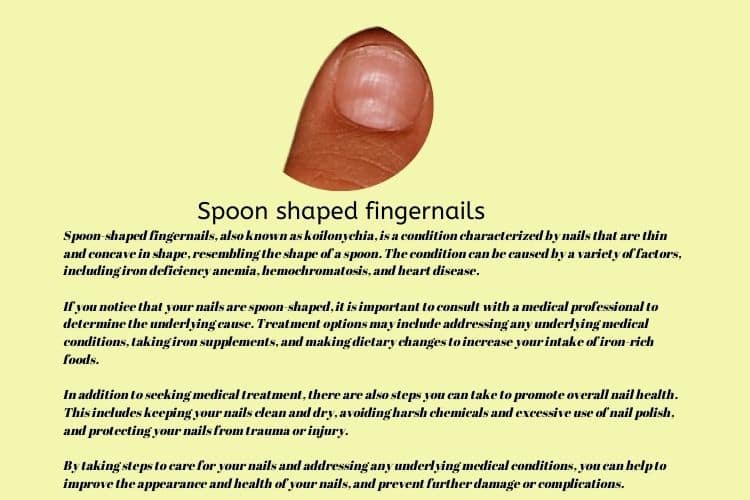 Spoon-shaped fingernails