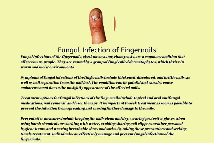 Fungal infection of fingernails