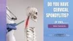 Blog banner image for Cervical spondylitis