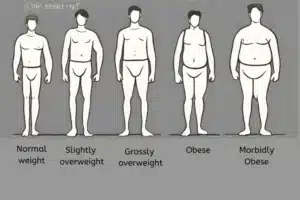 Image showing different stages of obesity with increasing waist to hip ratio.