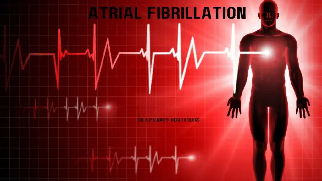 Atrial fibrillation 20240401 155724 0000