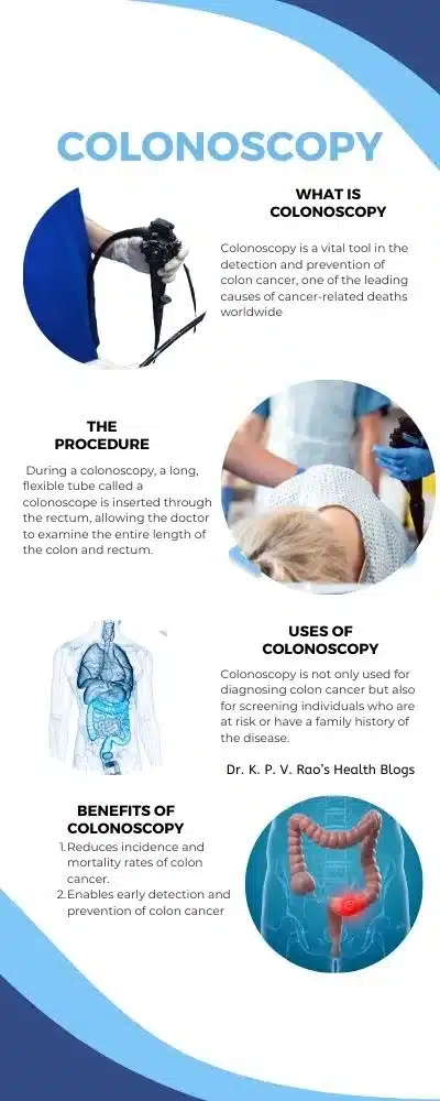 Infografía de colonoscopia como parte de la endoscopia.