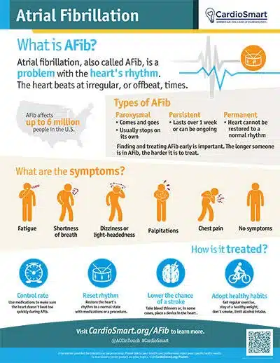 Image showing signs and symptoms of atrial fibrillation 