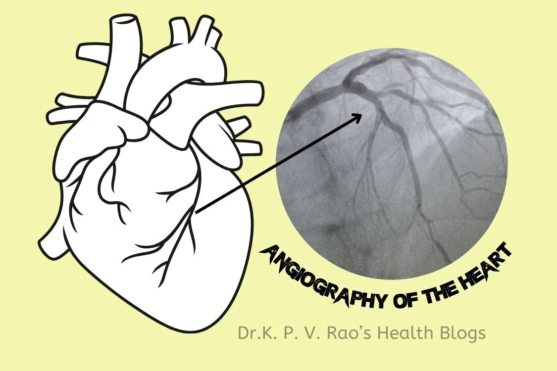 Featured image for the article showing heart arteries and its angiography