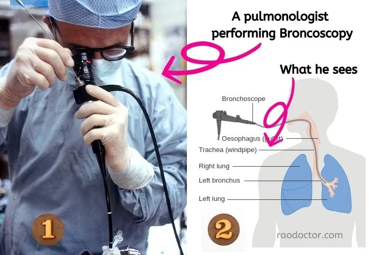 Bronchoscopy procedure