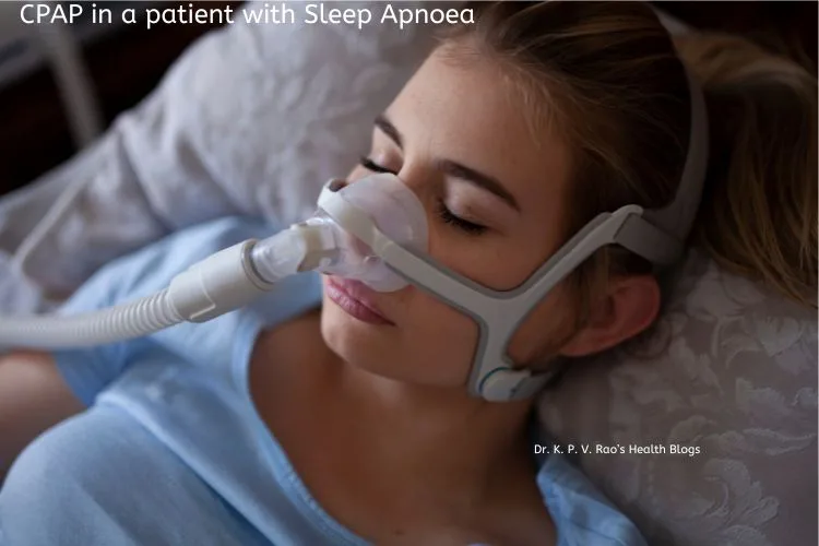 Paciente con apnea del sueño en cpap