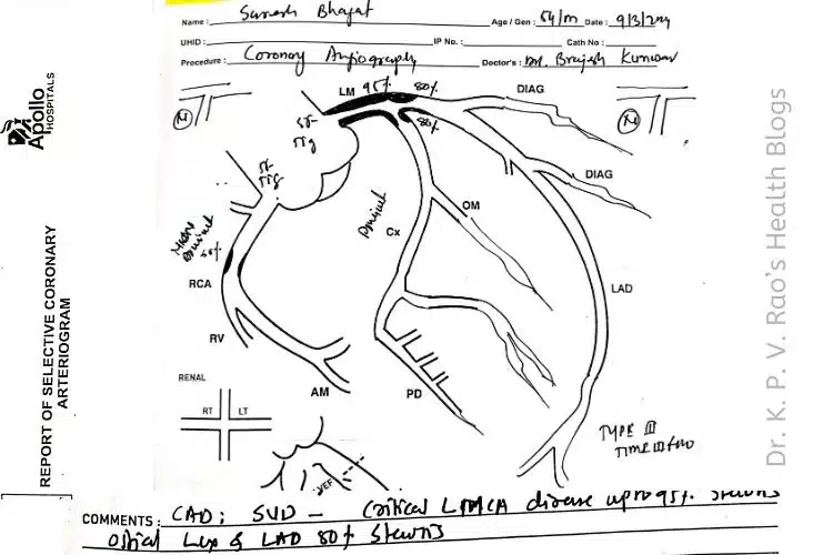 Heart angiography diagram of a realtime patient