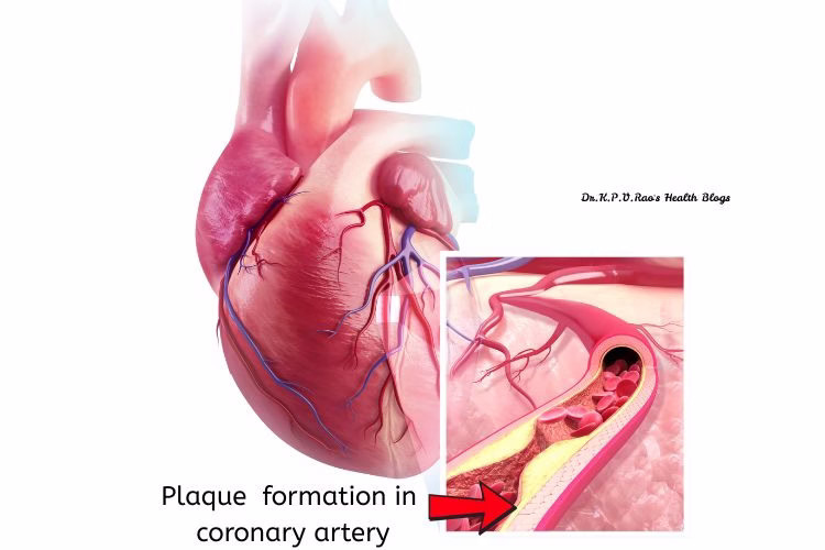 Plaque health can be assessed in ct angiography