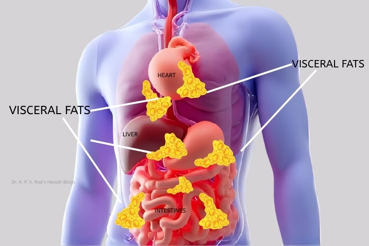Understanding Visceral Fat: Its Risks and Management 3 Distribution of visceral fat